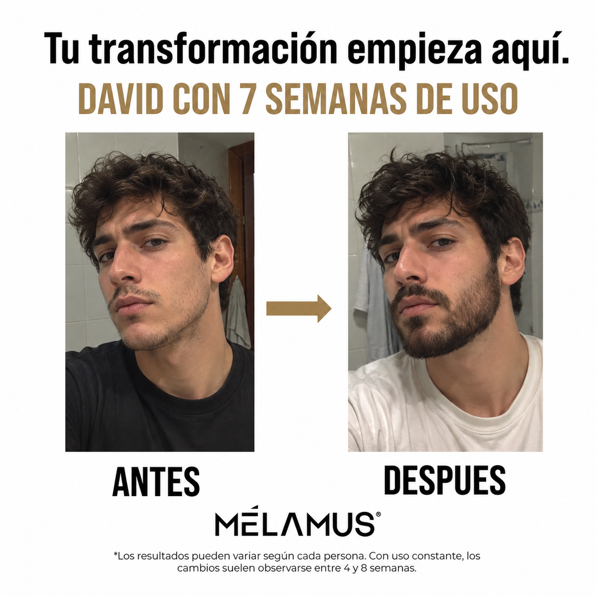 Crema MÉLAMUS™ — Recuperá la apariencia de tu barba