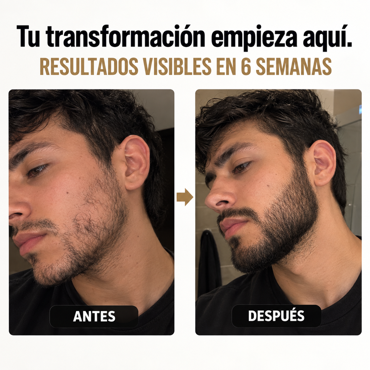 Crema MÉLAMUS™ — Recuperá la apariencia de tu barba